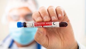 Hepatitis C