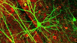 Neurona