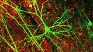 Neurona