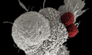 Terapia CAR-T