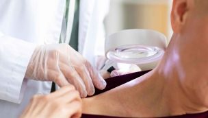 Estudios para detectar cáncer