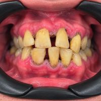 ¿Se te mueven los dientes y pensás que es normal?