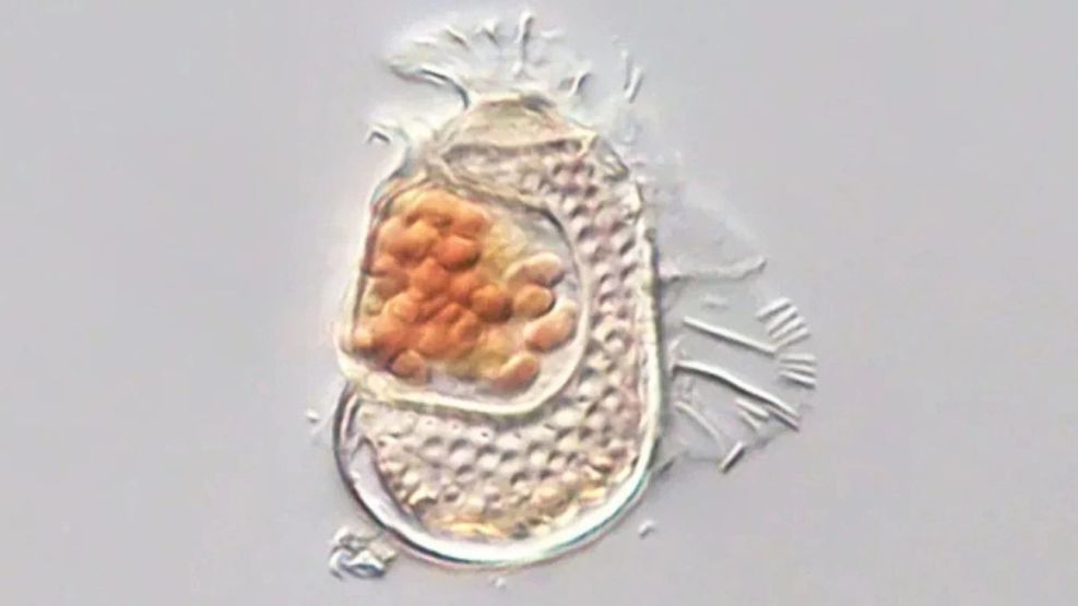 Dentro de este plancton de dinoflagelados se encuentra un microbio diminuto que se comporta más como un virus que como una célula.