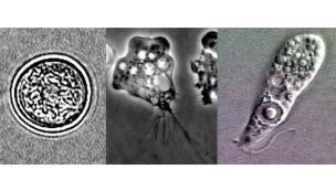 Naegleria fowleri: Ameba comecerebros