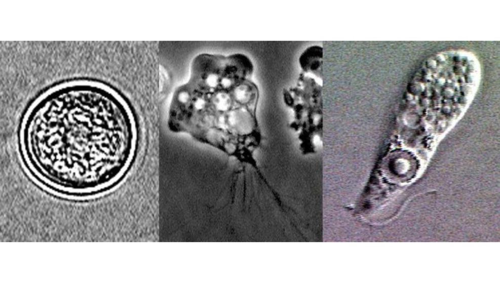 Naegleria fowleri: Ameba comecerebros