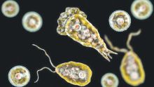 24_10_2026_ameba_comecerebro_cedoc_g