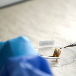 Un genetista forense trabaja con un molar humano para extraer ADN con el fin de identificar a personas desaparecidas durante la última dictadura militar argentina (1976-1983), en un laboratorio de genética del Equipo Argentino de Antropología Forense (EAAF) en Córdoba, Argentina. Las autoridades judiciales argentinas en la provincia de Córdoba anunciaron la identificación de ocho personas desaparecidas durante la última dictadura militar del país, cuyos restos fueron recuperados de una fosa común; con esto, el número de víctimas identificadas en dicho lugar desde septiembre de 2025 asciende a 38. | Foto:CESAR HEREDIA / AFP