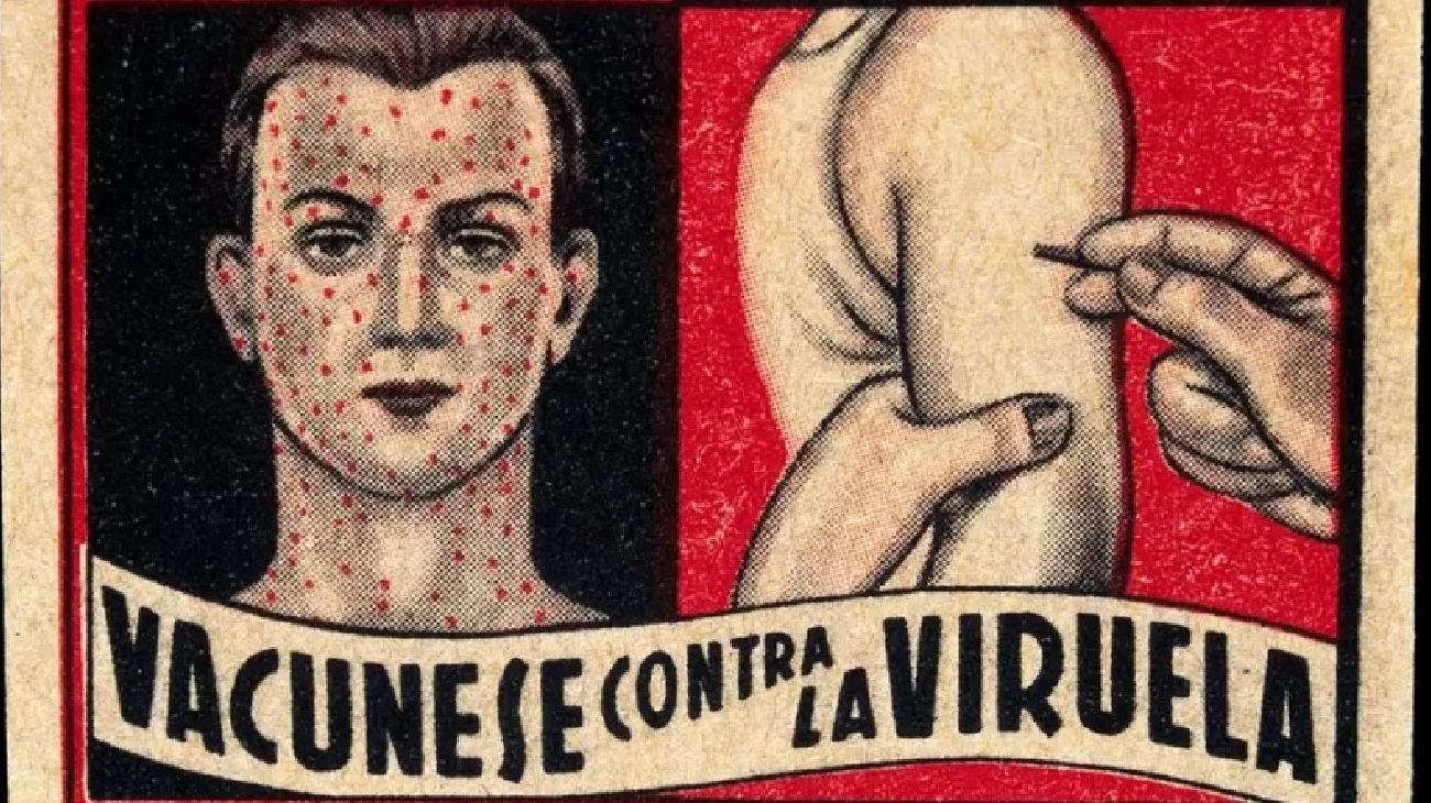 Viruela 20221026